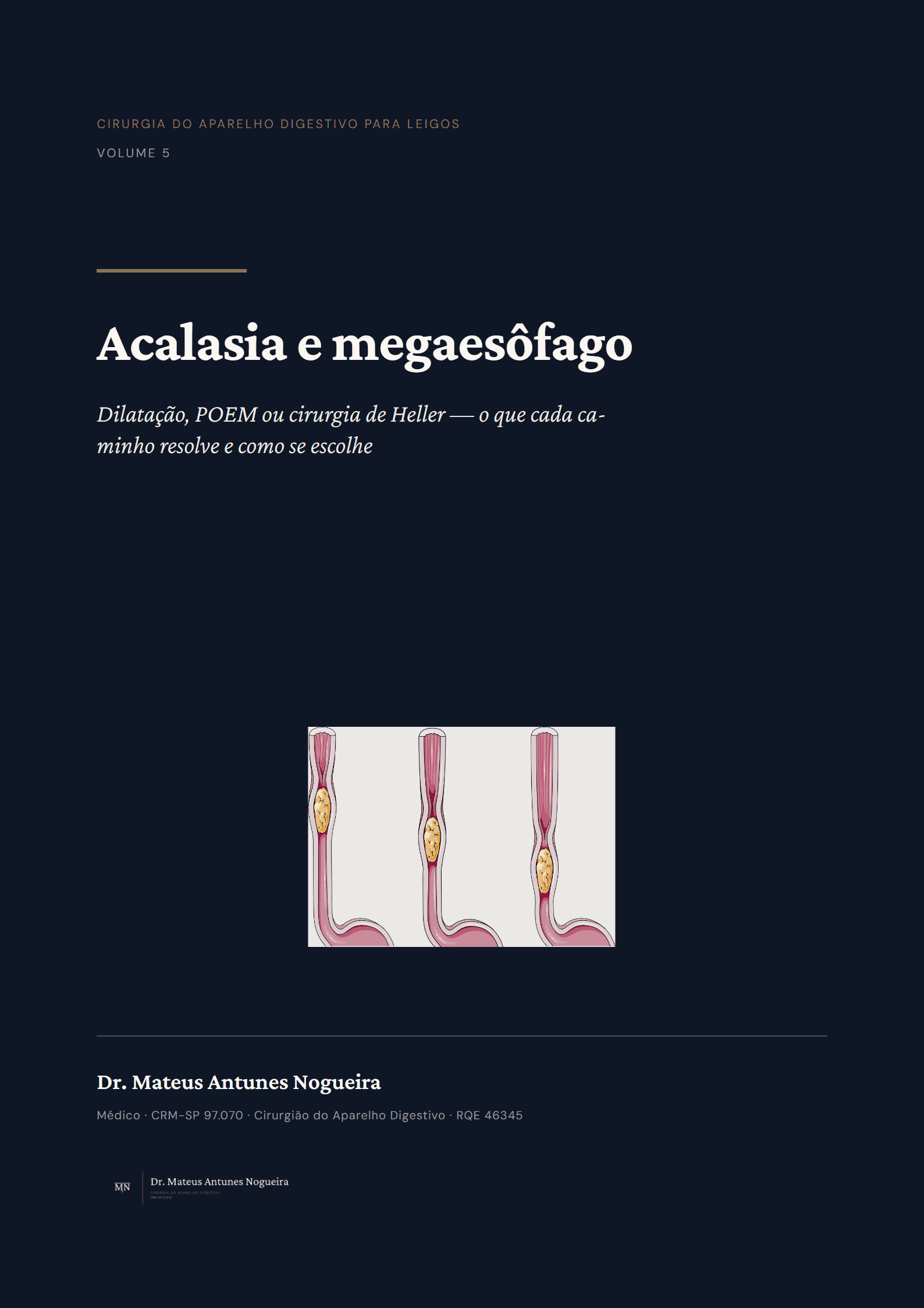 Capa do livro Acalasia e megaesôfago
