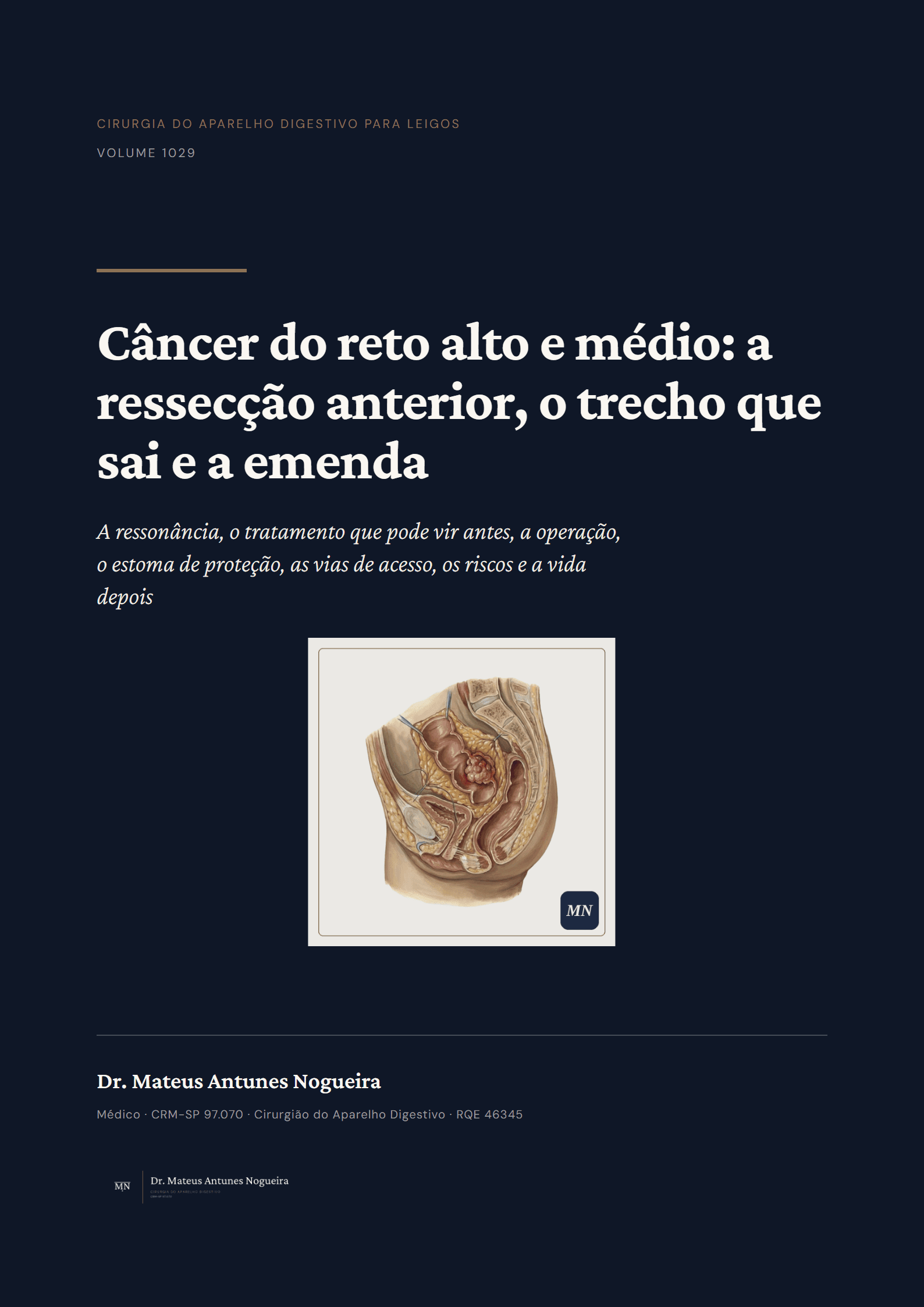 Capa do livro Câncer do reto alto e médio: a ressecção anterior, o trecho que sai e a emenda