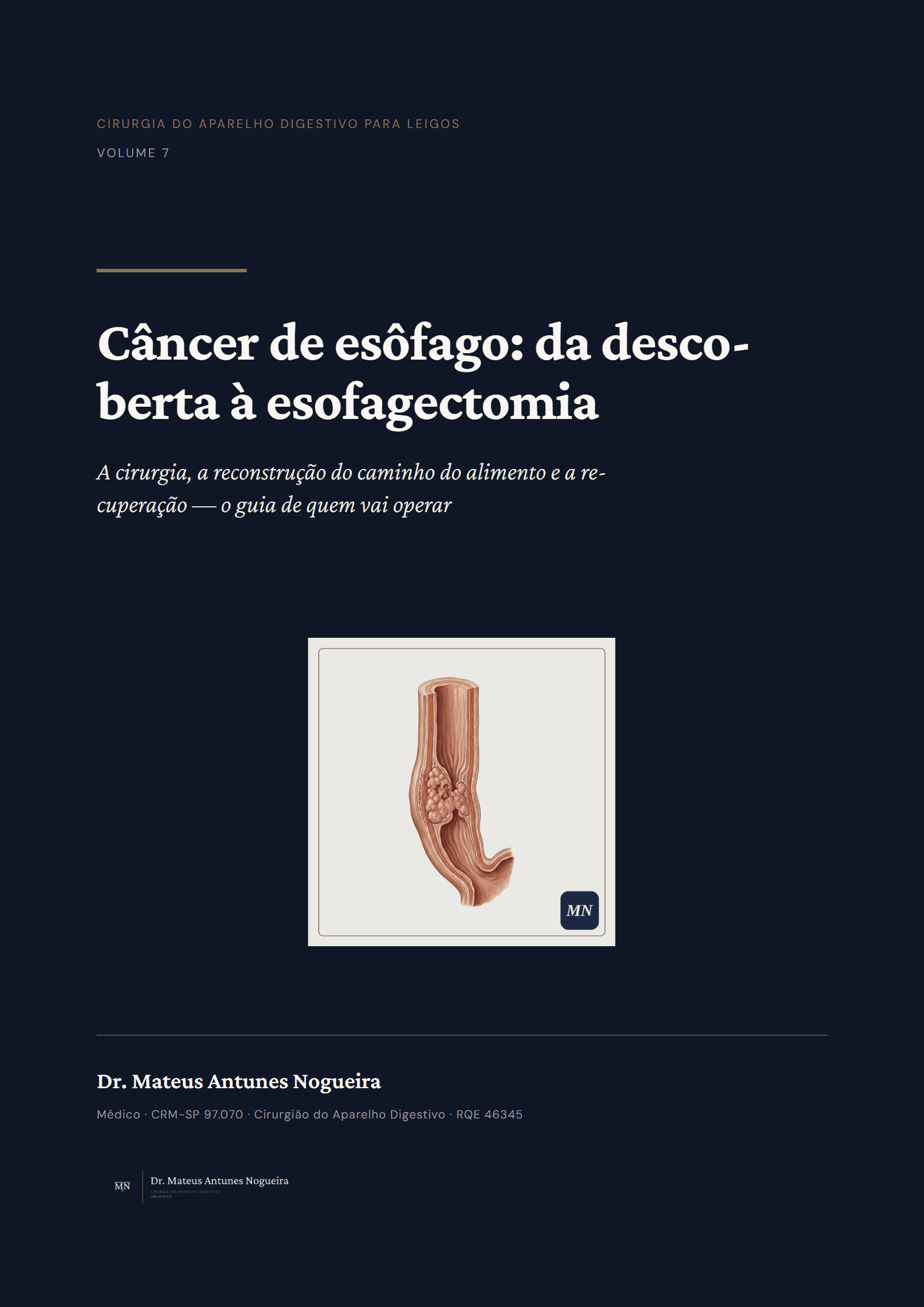 Capa do livro Câncer de esôfago: da descoberta à esofagectomia