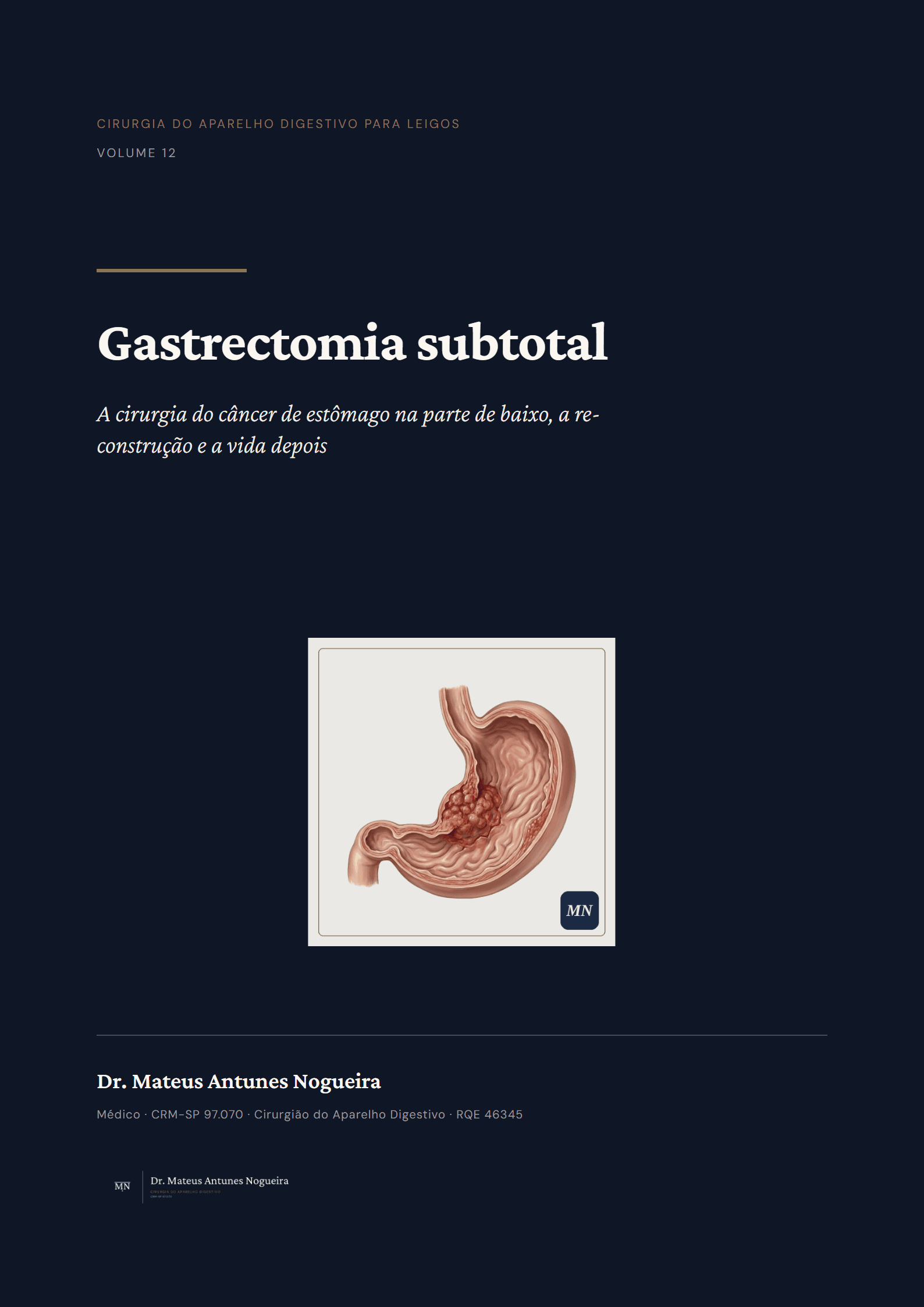 Capa do livro Gastrectomia subtotal