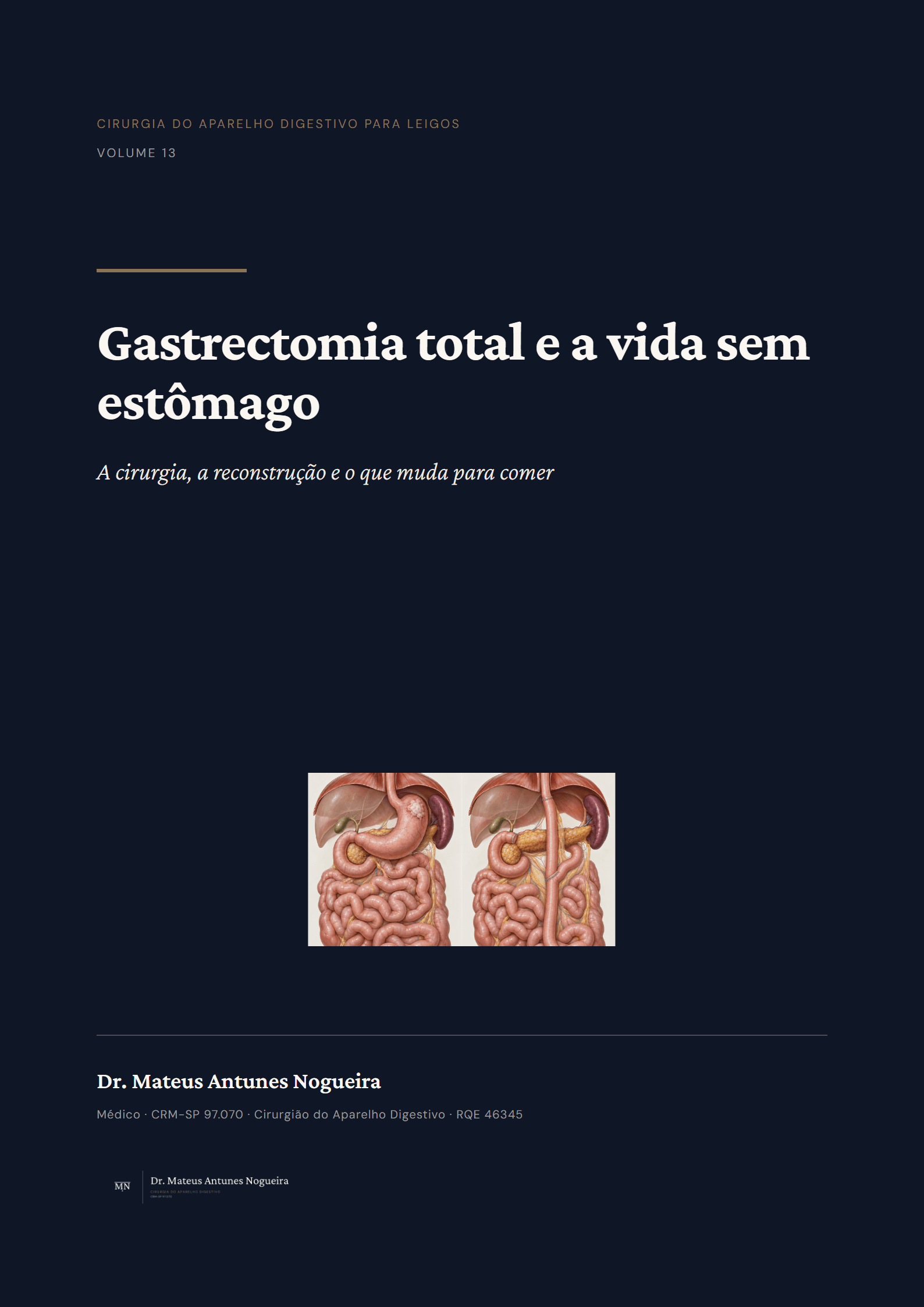Capa do livro Gastrectomia total e a vida sem estômago