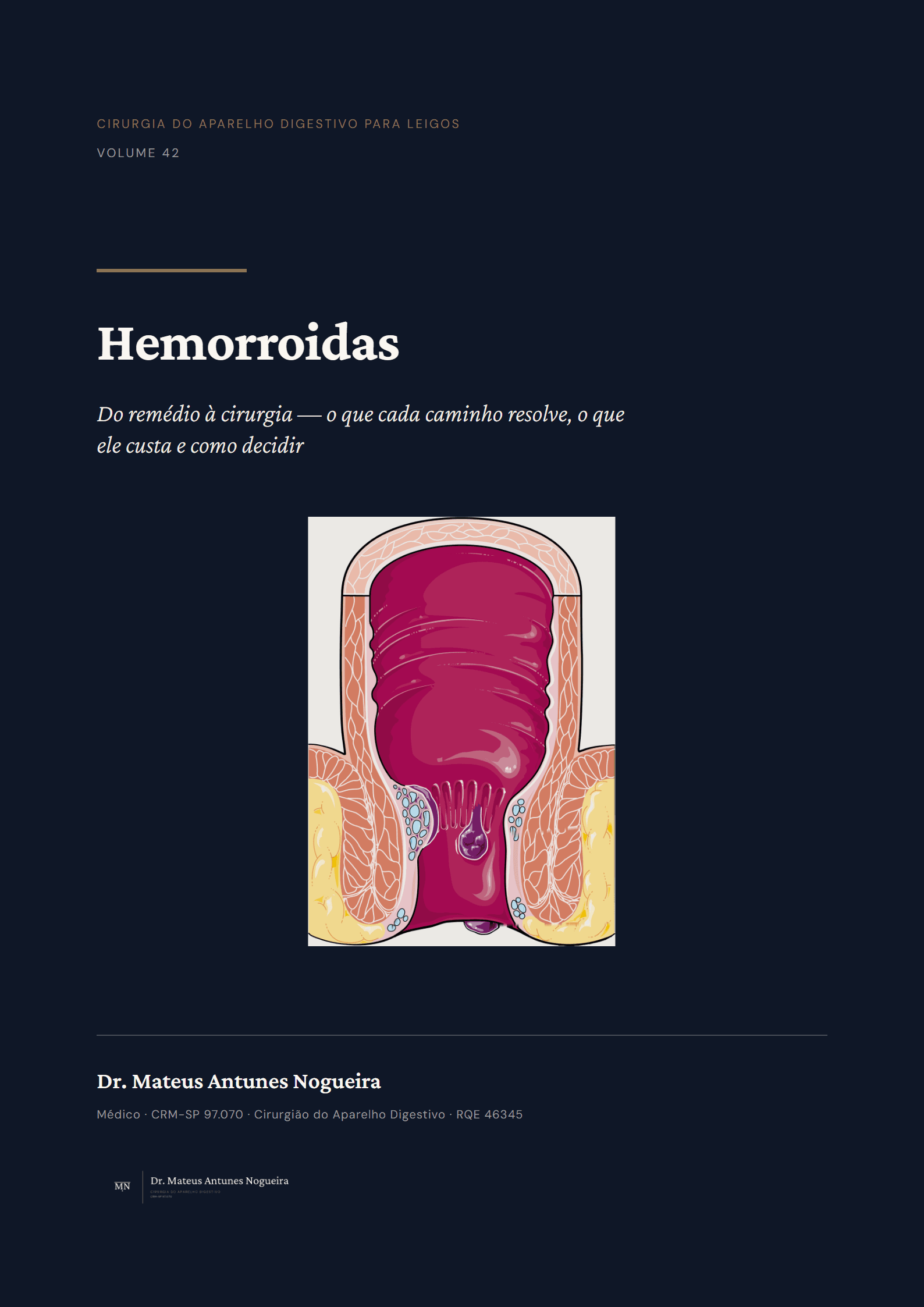 Capa do livro Hemorroidas