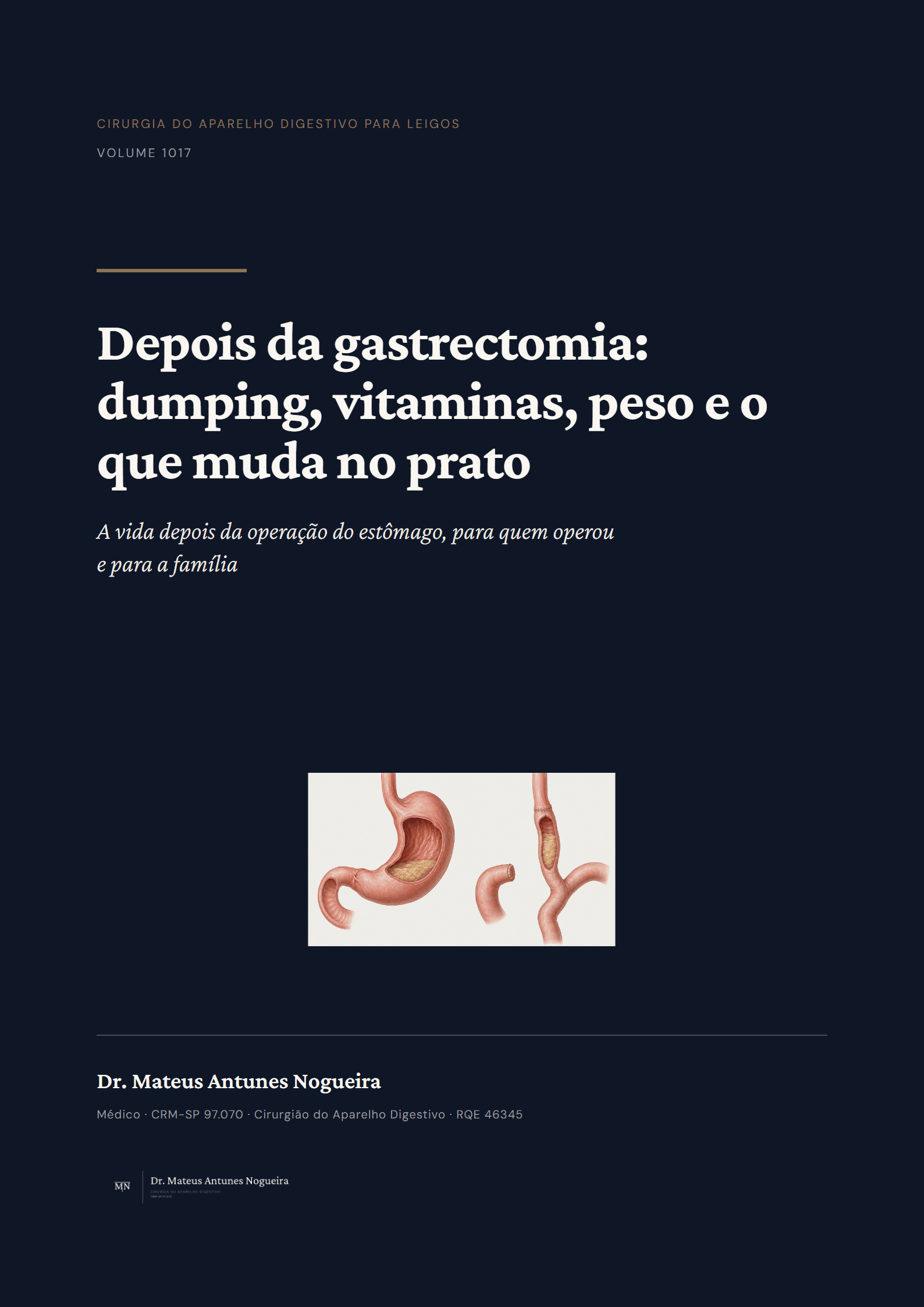 Capa do livro Depois da gastrectomia: dumping, vitaminas, peso e o que muda no prato