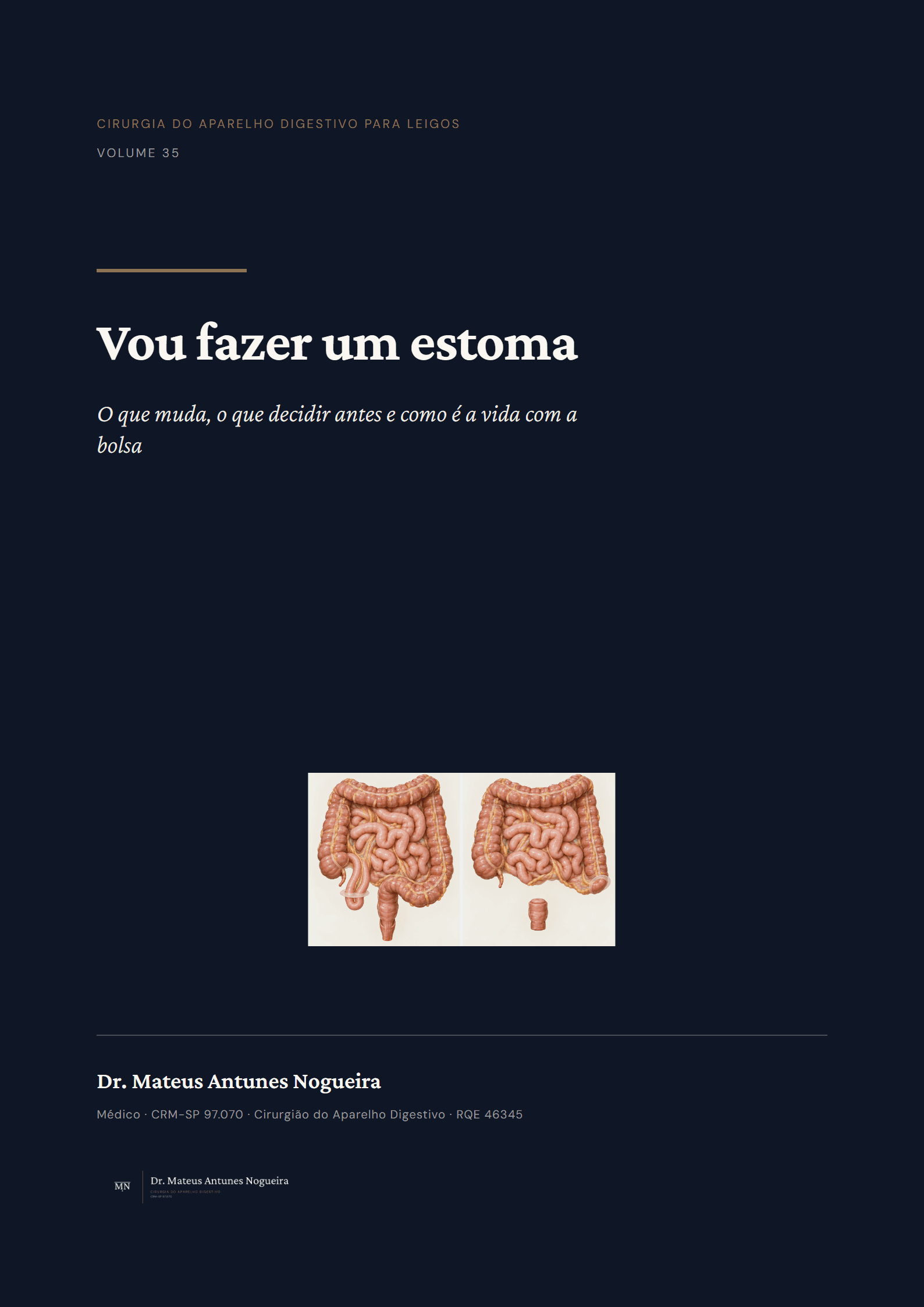 Capa do livro Vou fazer um estoma