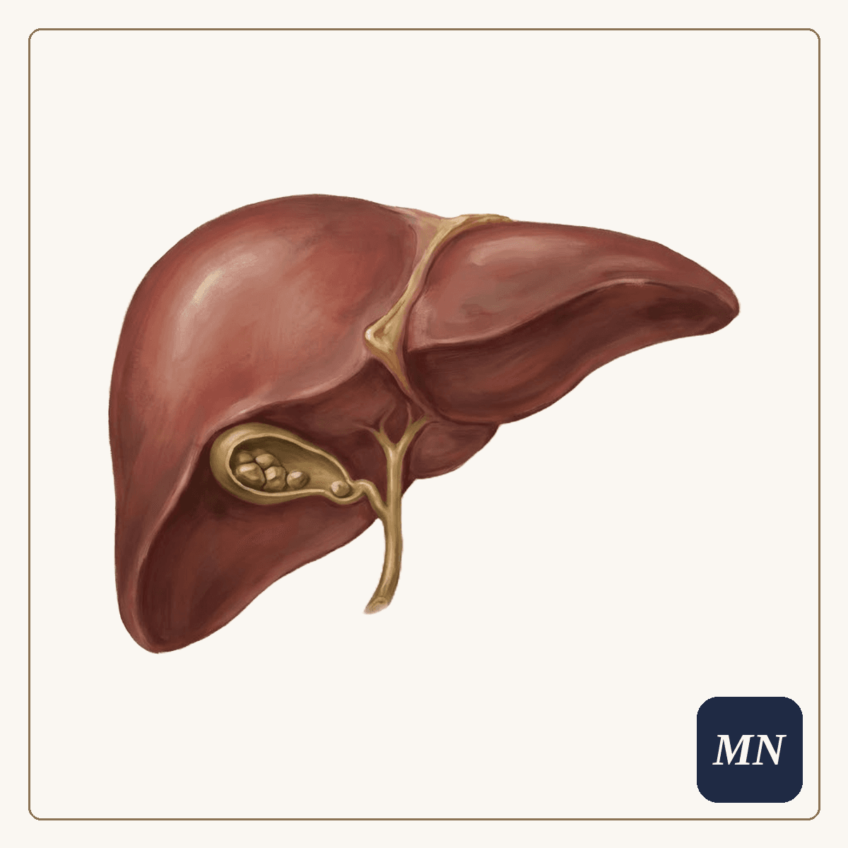 Ilustração anatômica — Doenças da vesícula e colecistectomia
